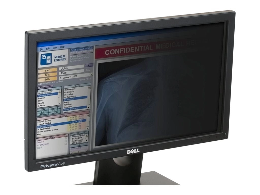 Computer Security Products Guardian Series - Display privacy filter - removable - 17.3 wide - black" G-PF17.3W9